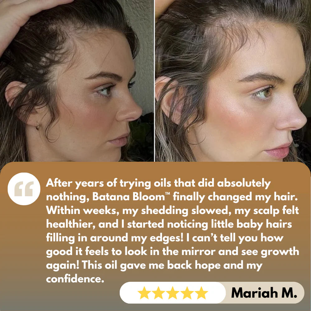 Batana Bloom™ Organic Hair Growth Elixir